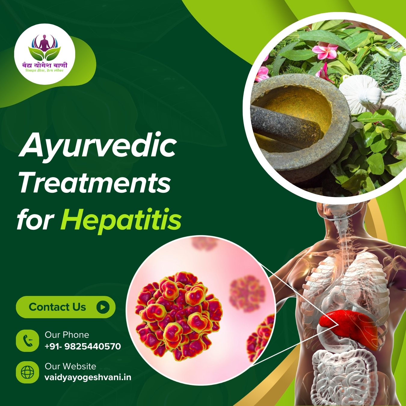 Is There a Natural Cure? Exploring Gallbladder Stone Ayurvedic Treatment 1 Is There a Natural Cure? Exploring Gallbladder Stone Ayurvedic Treatment